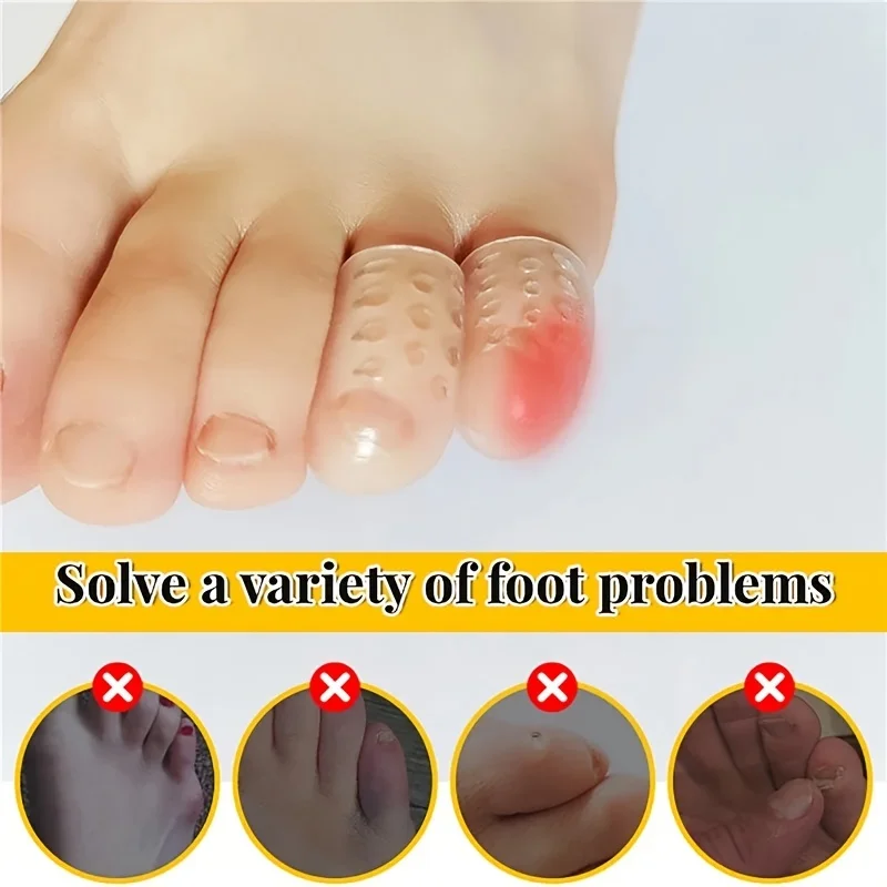 10x Silicone Toe Caps Protectors Anti-Friction Breathable Toe Covers Prevents Blisters Bunion Corrector Foot Care Pedicure Tools