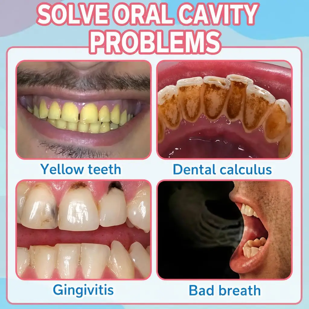 Advanced Cavity Protection – ERASE Early Cavities & Avoid the Drill – Advanced Enamel Repair Toothpaste, Instantly Blocks Decay, Long-Lasting Protection, Sensitive Teeth Safe, Naturally Freshens Breath, Save Thousands on Fillings