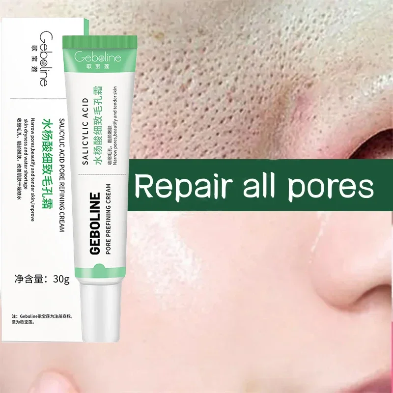 Crema retráctil de poros con ácido salicílico, elimina rápidamente los poros grandes, elimina los puntos negros, repara el estiramiento facial,