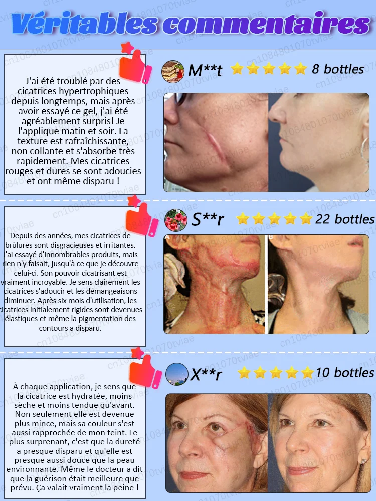 Zorg voor je littekens en laat het ze helpen oplossen