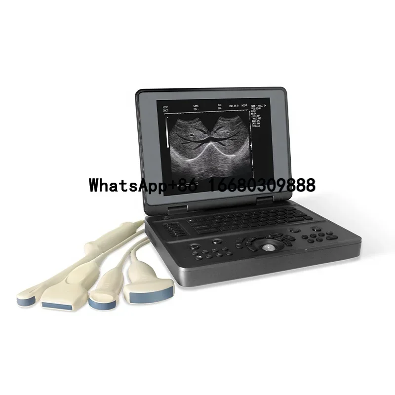 YSB3000W Ysenmed portable B/W Notebook ultrasound black and white ultrasound manufacturer low price human ultrasound machine