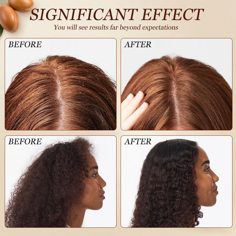 100ml Moroccan Argan Hair Essential Oil Hair Salon Care Serum Anti-Frizz Repair Dry Damaged Hair Nourish Scalp Add Shine Hair view 6