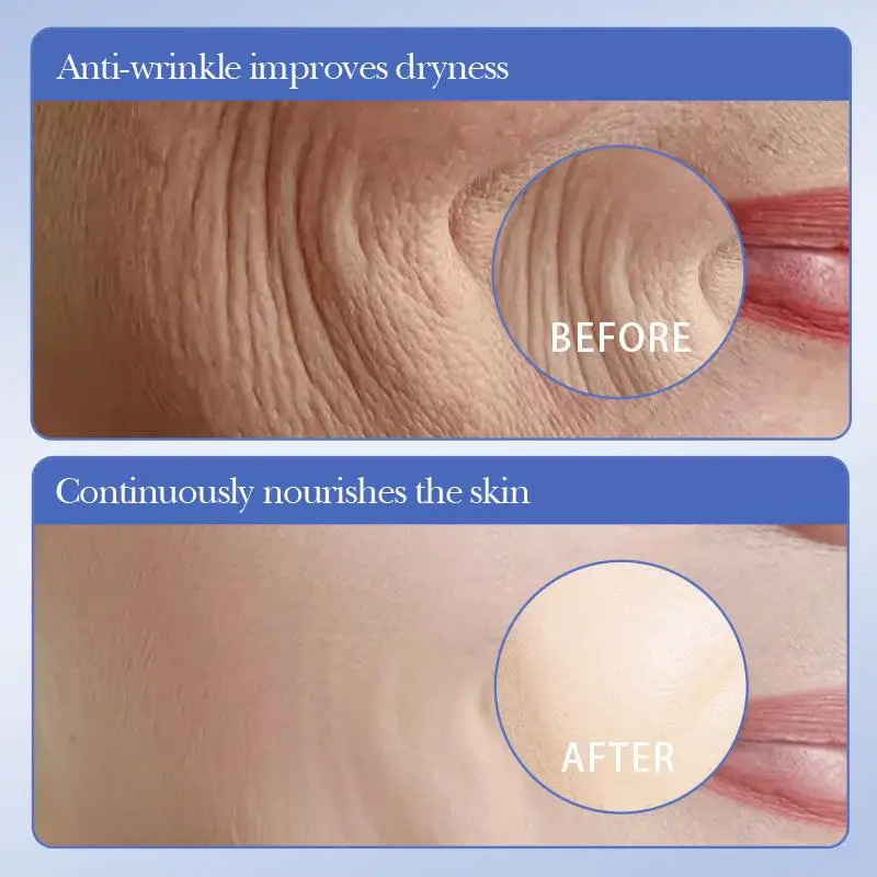 SADOER Caviar Hyaluronic Acid Face Masks (10pcs) 5