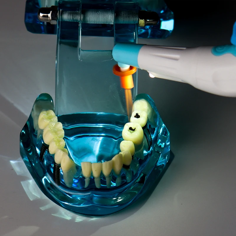 Kit de irrigador de canal radicular RW-7 equipado com 30 cabeças de plástico S/M/L, descarga endodontia eficiente, para limpeza e enxágue de canal