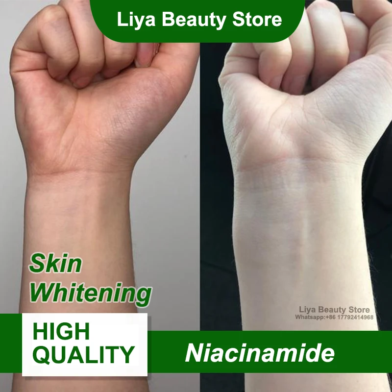 Meilleur vendeur 99% Niacinamide poudre ingrédients de matières premières cosmétiques pour le blanchiment de la peau