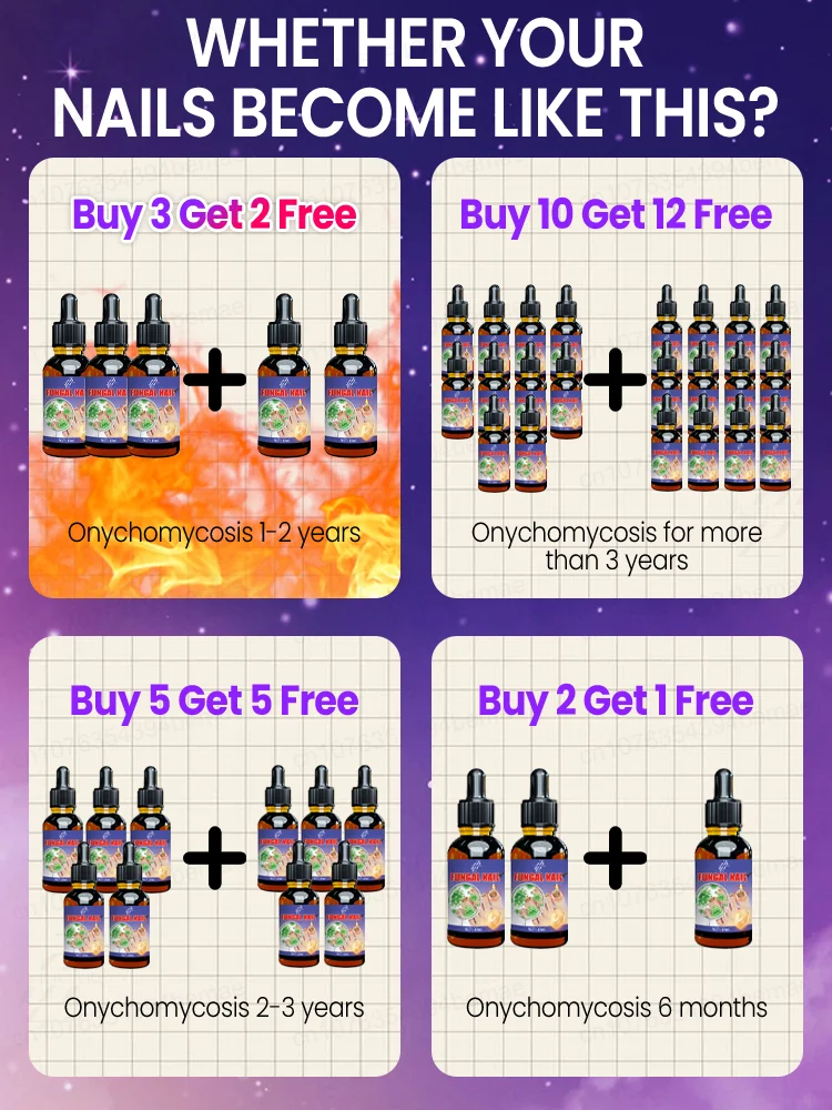 ᴿᵉᵐᵒᶜ̧ᵃ̃ᵒ ᵖʳᵒᶠⁱˢˢⁱᵒⁿᵃˡ ᵈᵒ ᶠᵘⁿᵍᵒ ᵈᵒ ᵖʳᵉᵍᵒ