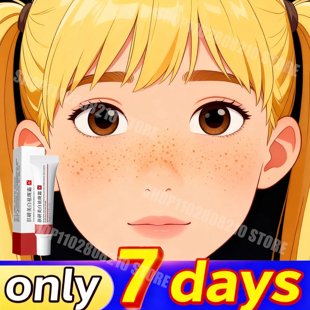 Freckle Cream Whitening Firming Moisturizer Reduce Melanin Lighten Dark Spots Skin Care1