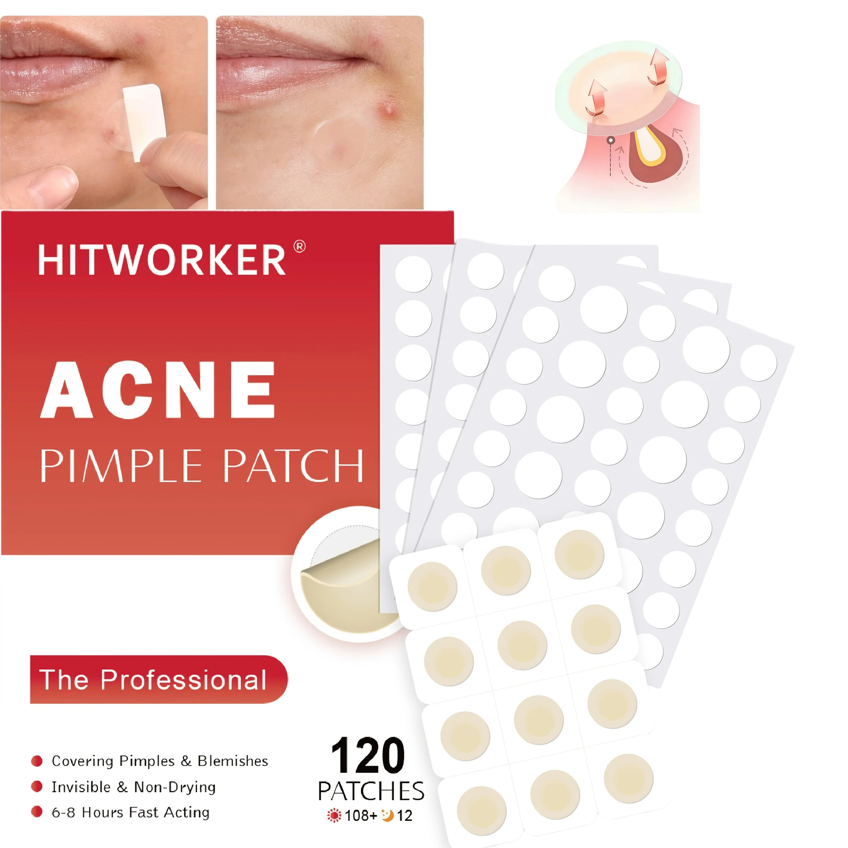 

120pcs Day & Night Acne Patch Set, Hydrocolloid + Transparent, Ultra-Thin Waterproof Spot Stickers, Gentle Mixed Sizes Care