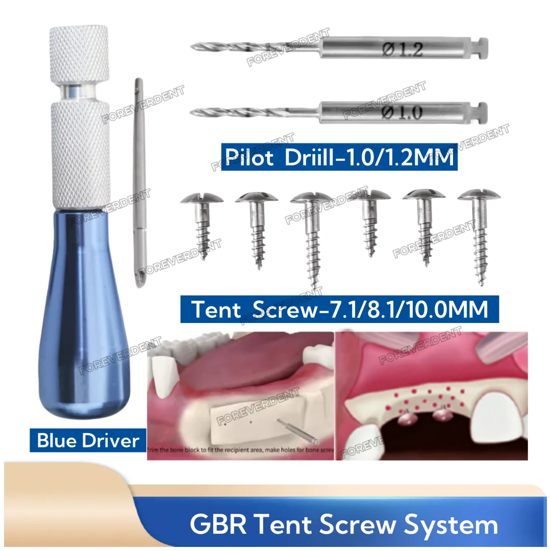 Dental Driver Tent Nails Half Thread Screw Titanium Guid Regeneration Membrane Tenting Holder Bone Fixation Screws Screwdriver