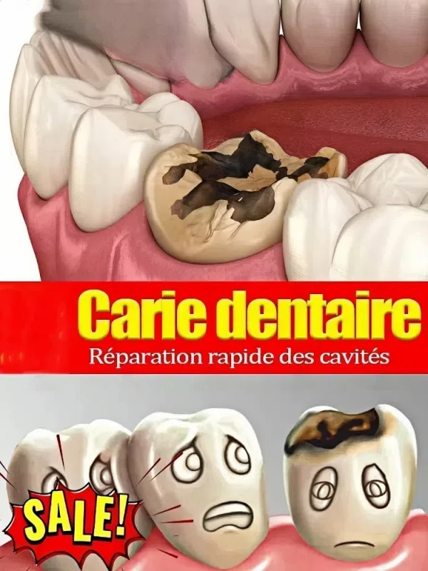 Toothpaste of Teeth Whitening Repair of Cavities Caries Removal of Plaque Stains Decay Repair Teeth Treating Dental Calculus