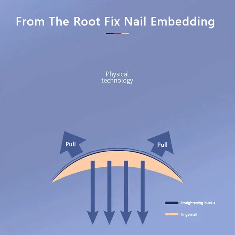 Correcteur d'ongles incarnés, outils de pédicure, récupération intégrée, traitement des ongles des orteils, Correction professionnelle des ongles incarnés, outil de soins des pieds