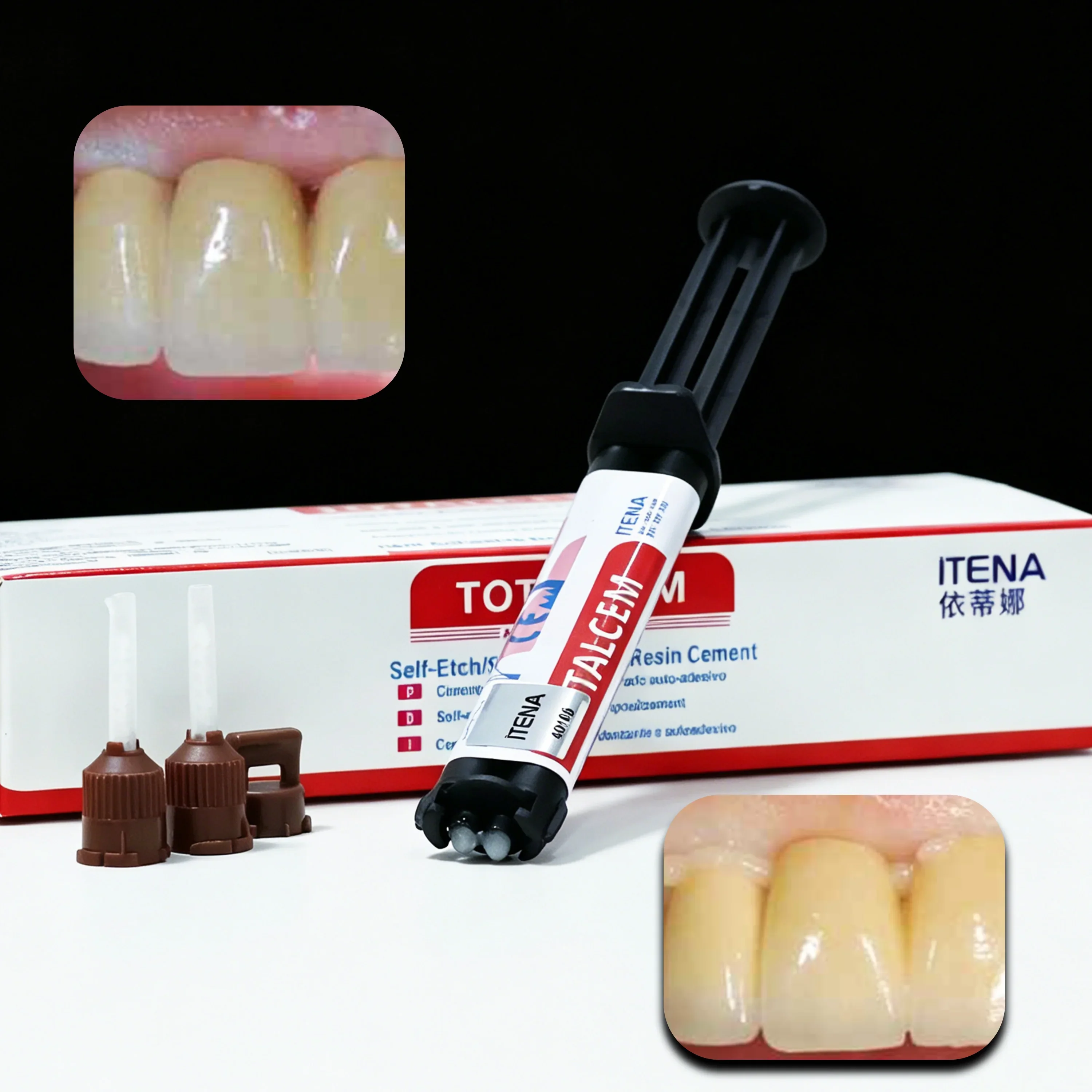 ITENA TOTALCEM Self-Adhesive Dual Cure Resin Cement 8g - Permanent Bonding for Dental Crown, Veneer & Inlay