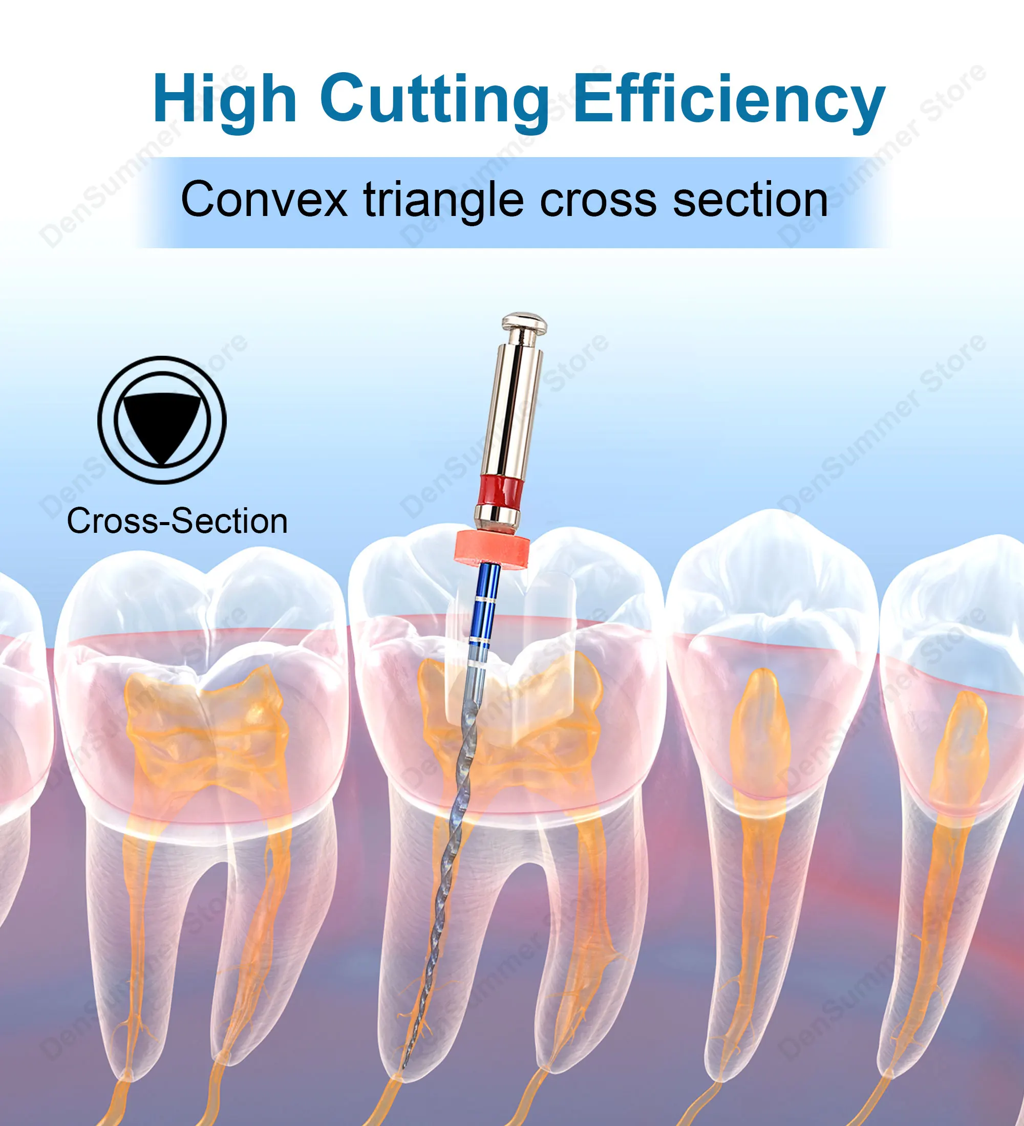 DenSummer Dental Rotierende Endodontische Feilen 04 06 Taper, Wärmeaktivierte Nadelfeilen für Wurzelkanalreinigung und -behandlung – Detail 6