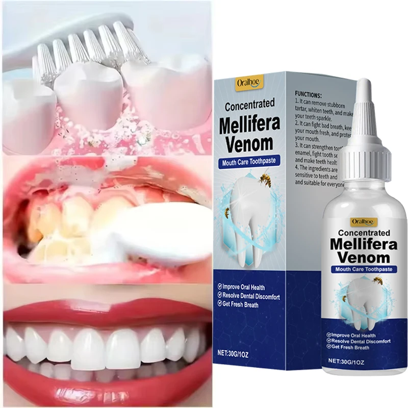 Pulizia dei denti Siero sbiancante Rimuovi placca Denti bianchi Gel Denti Macchie di fumo giallo Dentifricio Alito fresco Cura dell'igiene orale