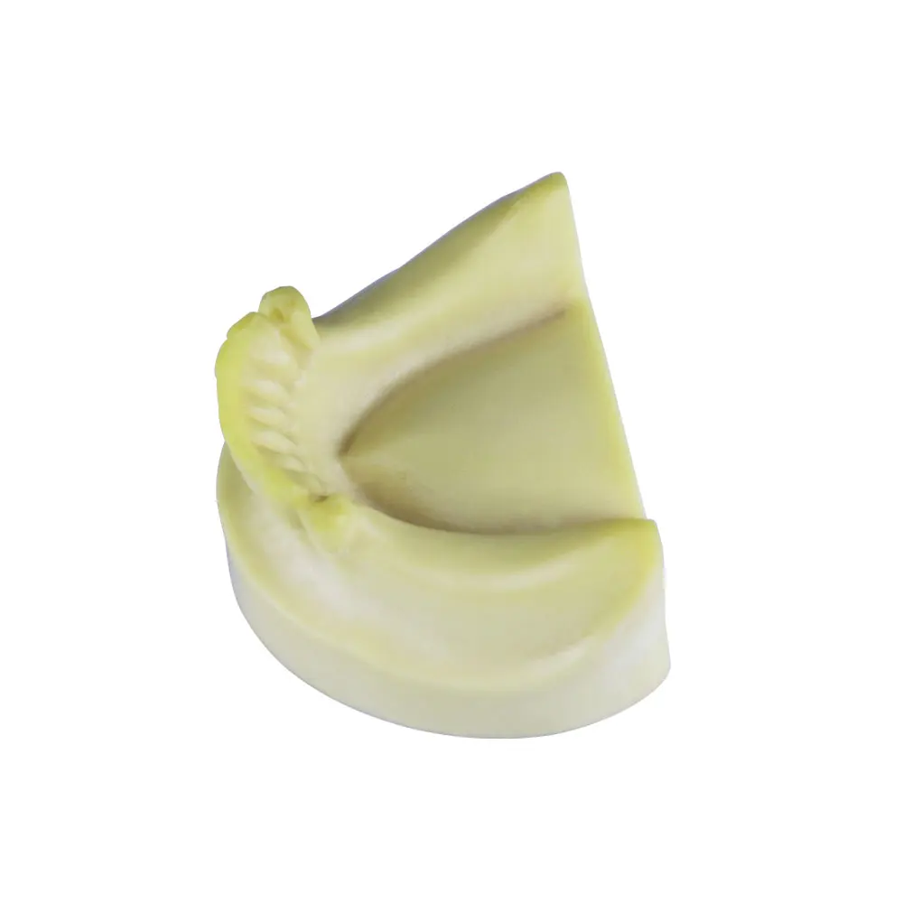 1pc Dental Teeth Model Practice Dentist Training Model Missing Tooth Denal Teaching Model For Dental Students Studying Examation