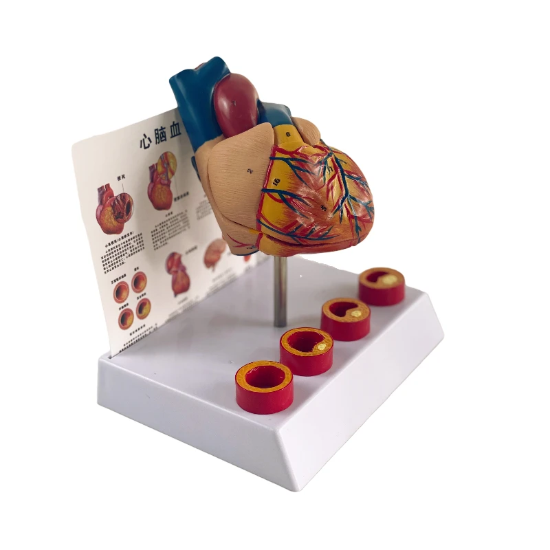 Removable Anatomical Human Life Size Heart Medical Cardiovascular Anatomy Thrombotic Vascular Model 18x14x23cm