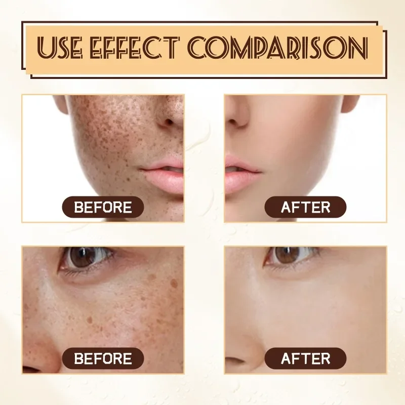 Effective Whitening Serum Remove Dark Spots Freckle Essence Anti-Aging Fade Pigmentation Melasma melanin Brighten Skin Care