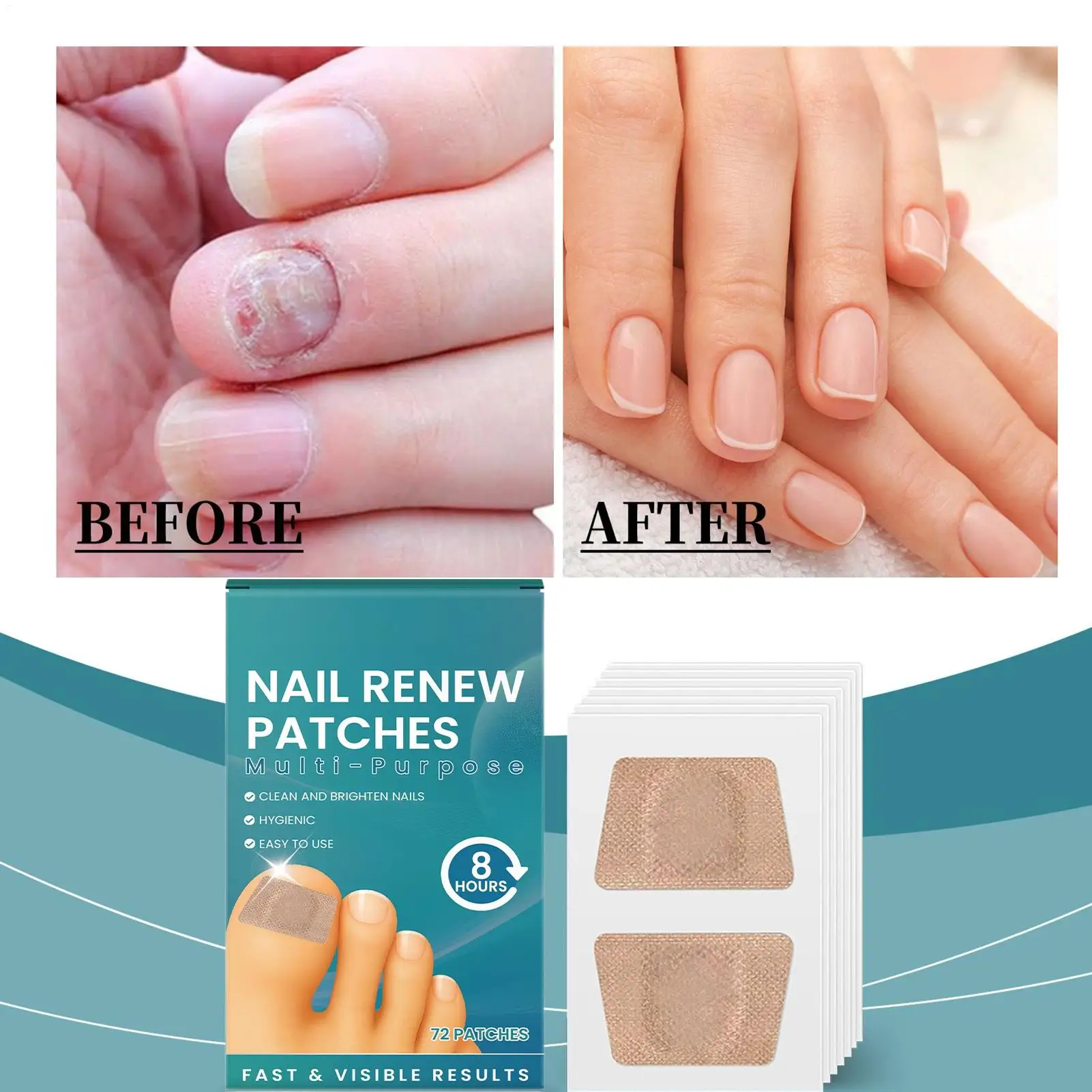 손톱 수리 패치 72피스 손상된 손톱 케어 패치 부러진 분할 자란 여성용 손톱 케어 스티커 강화