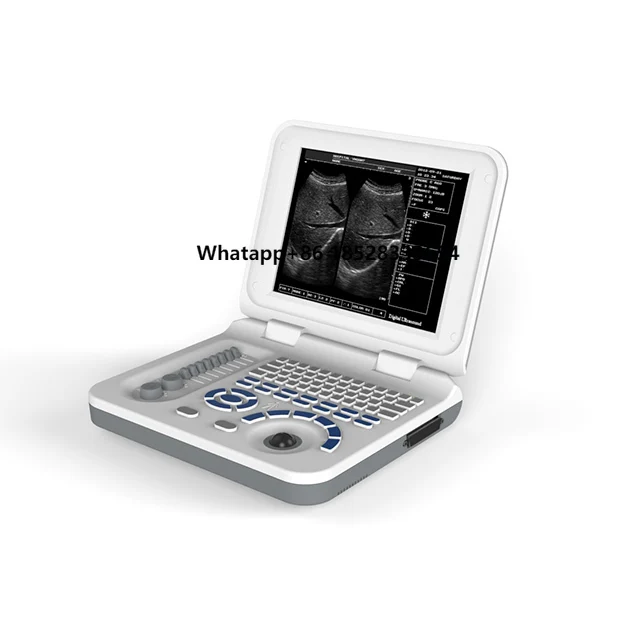 Factory Wholesale Medical Portable Ultrasound Diagnostic Equipment Ultrasound Machine Scanner