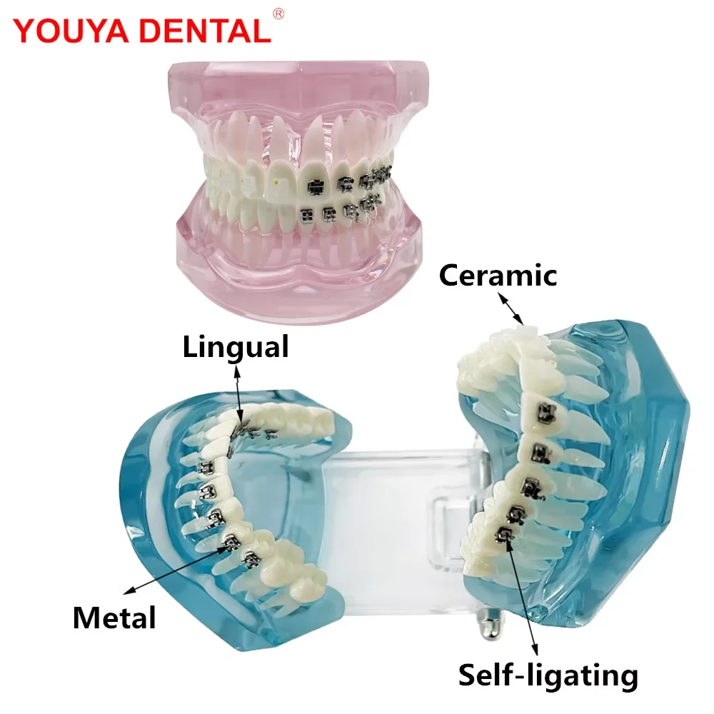 Dental Model Teeth Teaching Model With Self Ligating/ Metal/ Lingual/ Ceramic Orthodontic Brackets Teeth Model For Studying Demo