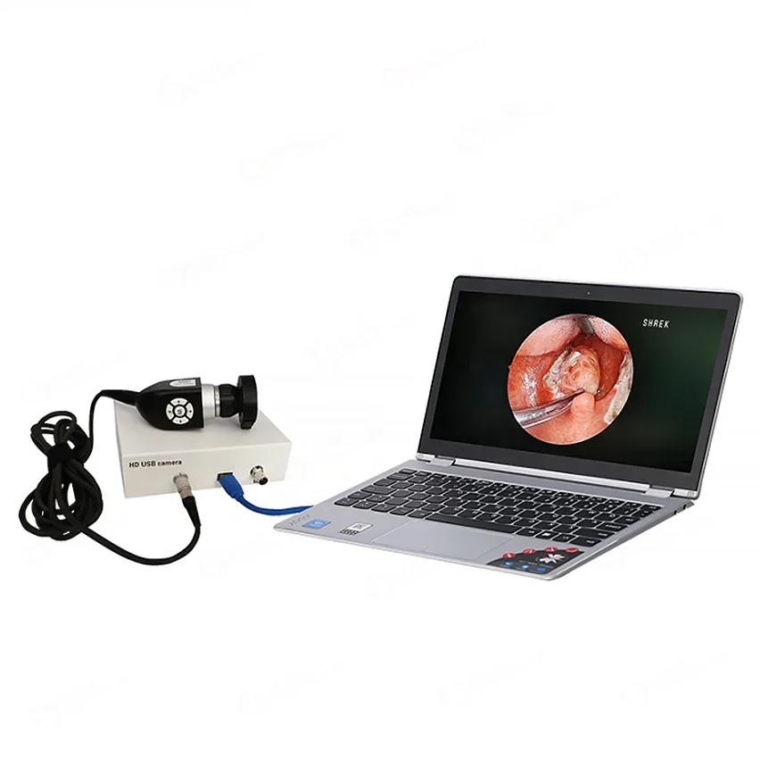 

Портативная медицинская эндоскопическая камера SDI, USB CMOS