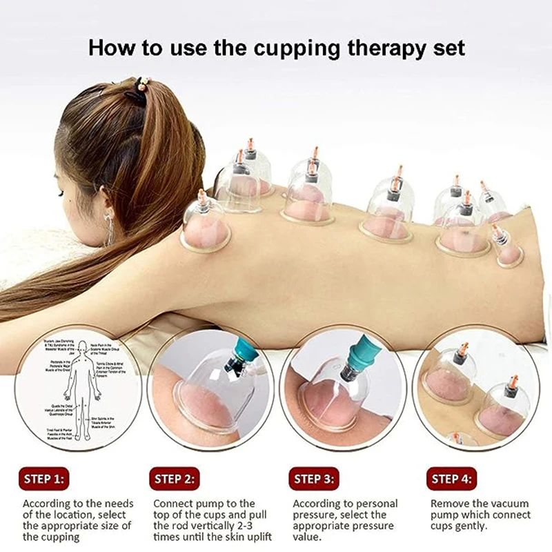 32/24/18/10/6 Cupping Therapy Set Vacuum Massage Tool Cupping Cup Massage Tool Set Ventosaterapia Masaje Profissional Copo