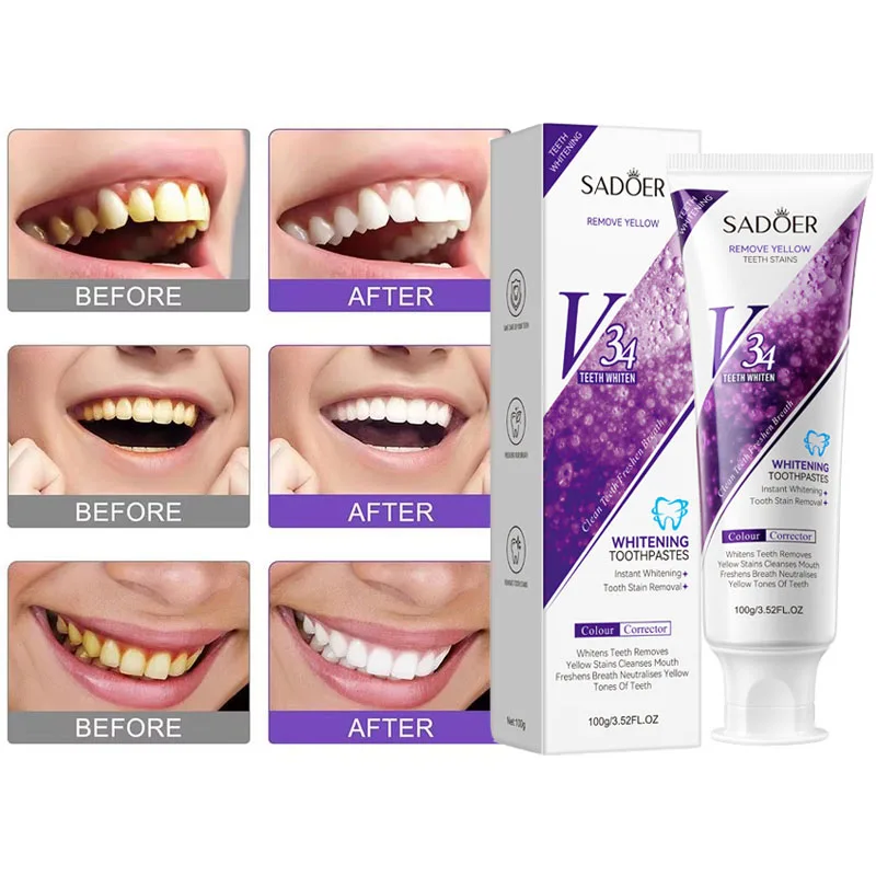 

100g V34 Whitening Toothpaste Removes Tartar Yellow Teeth Clean Oral Hygiene Fresh Breath Whitening Teeth Care Products