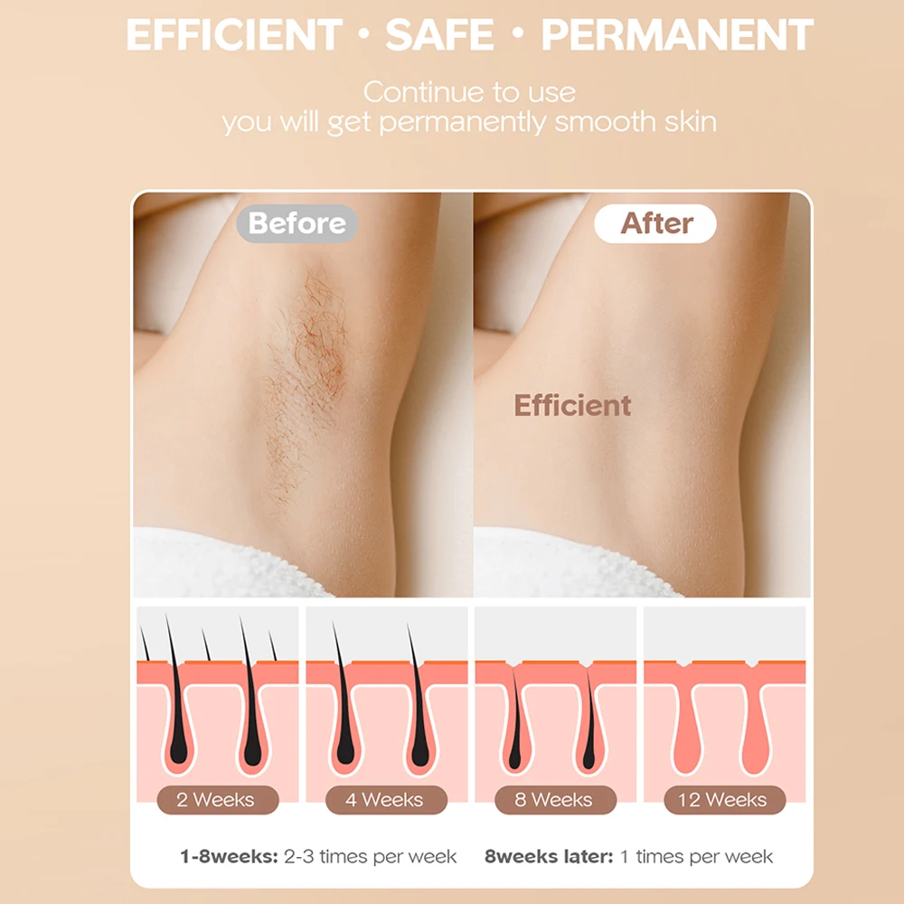 At-Home IPL Hair Removal for Women&Men Permanent 999,000 Flashes Painless Hair Remover on Armpits Back Legs Arms Face Bikini Lin