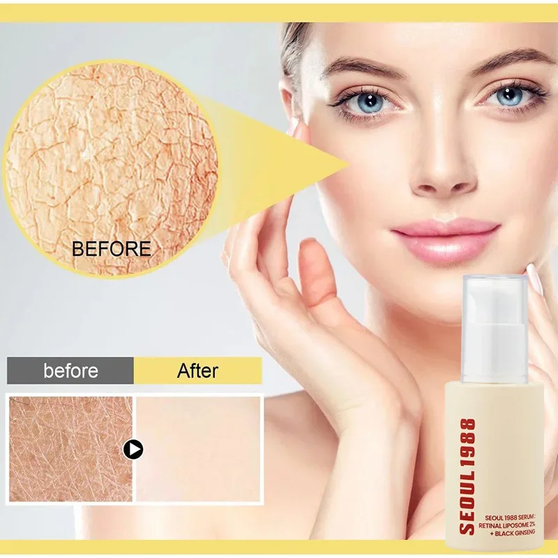 سيول 1988 100 مللي مصل شبكي ماركة الجينسنغ جوهر الوجه كوميدونز مغلق اشراق ترطيب الوجه جوهر العناية الكورية #3