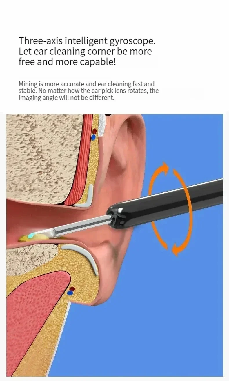 TINSOL Smart HD Visueller Ohrenreiniger 1080P Ohrenschmalz-Entferner Otoskop USB-C Wiederaufladbares Endoskop Ohrenschmalz-Reinigungswerkzeug Gesundheitspflegeset – Detail 12
