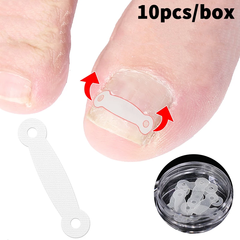 10PCS Trattamento delle unghie dei piedi incarnite Strumento di correzione dell'unghia del piede incarnita Adesivo patch elastico Raddrizzamento Clip Brace Strumenti per pedicure