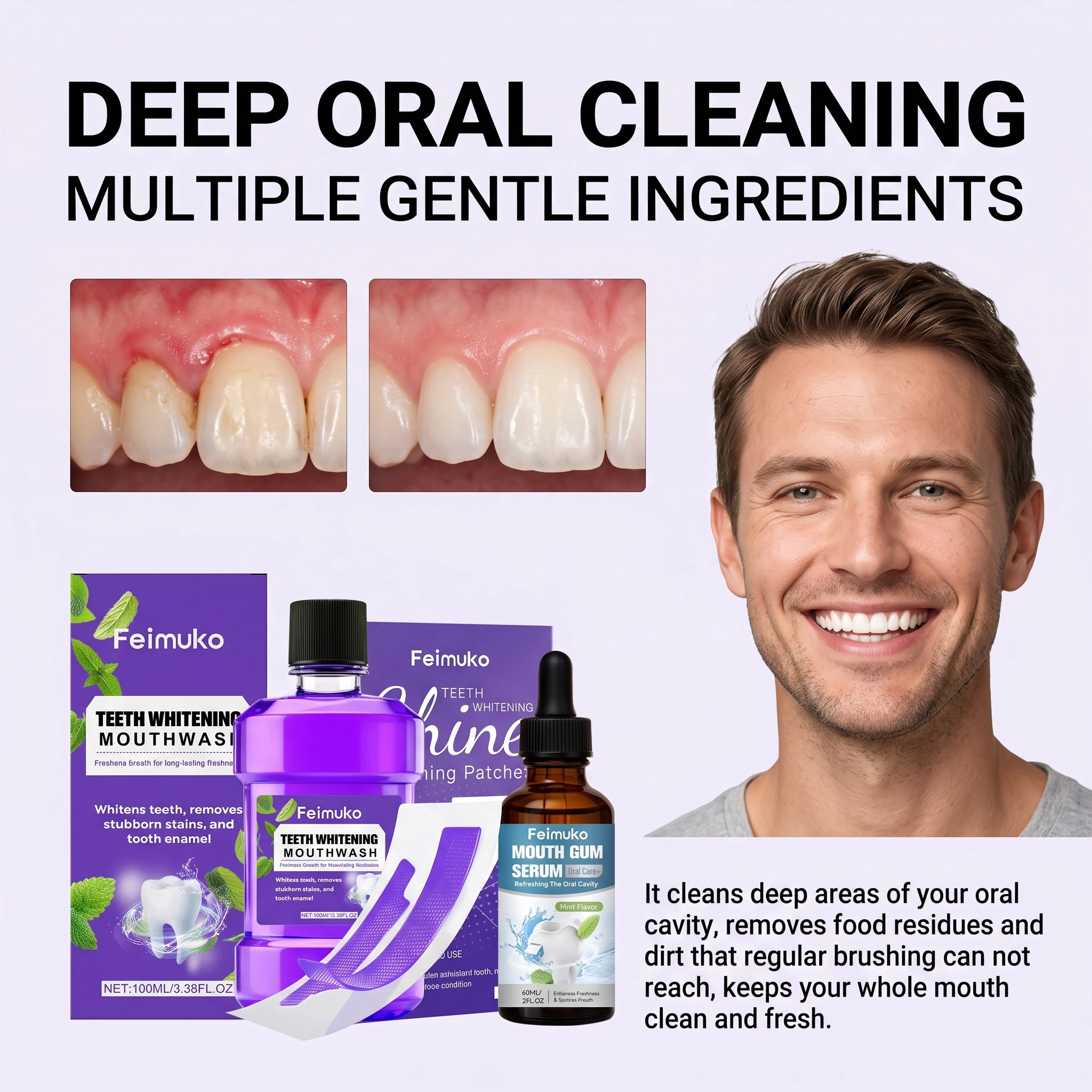 Kit de Soins Bucco-Dentaires : - Teeth Whitening Strips avis et prix