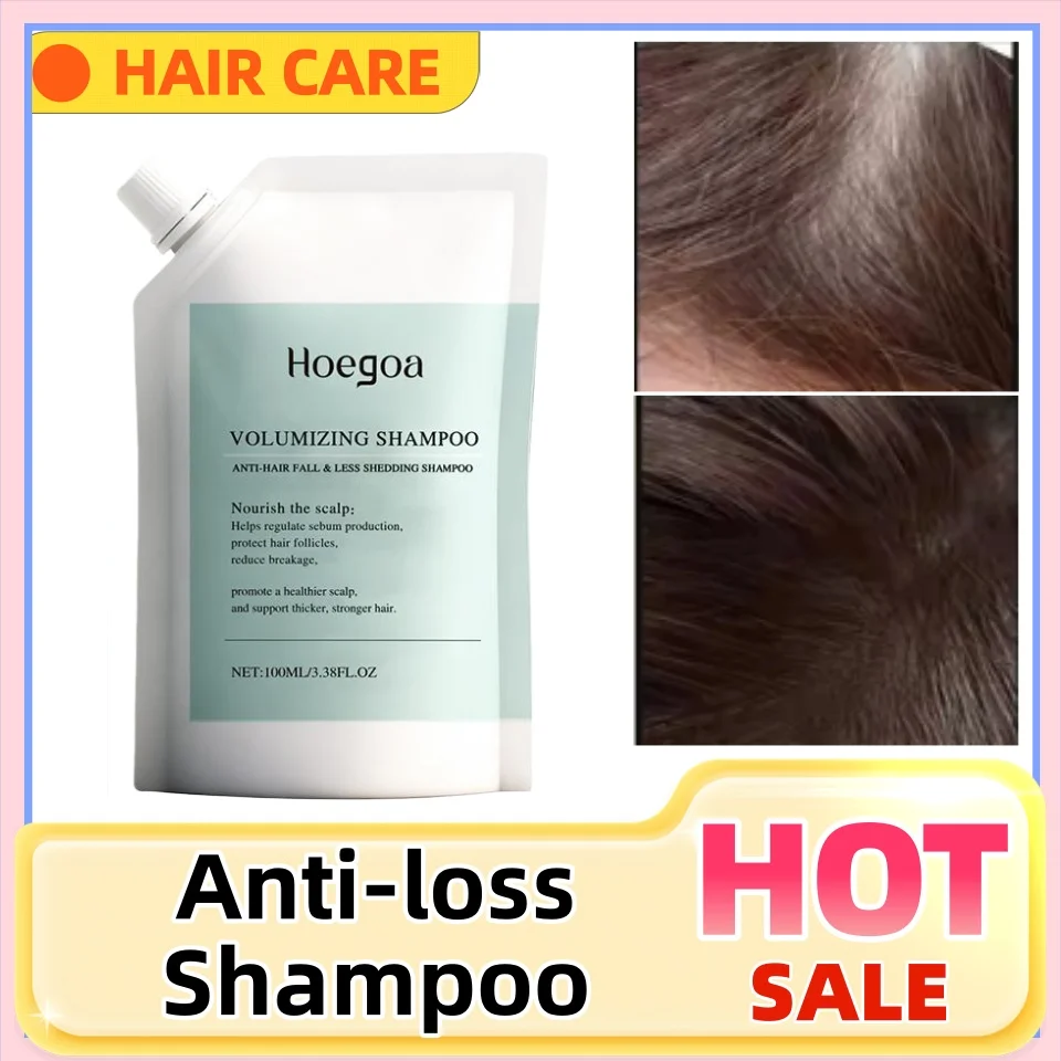 

100 мл шампунь против выпадения волос, контроль жирности волос, глубокая очистка кожи головы, объемная сыворотка, шампунь для ухода за волосами