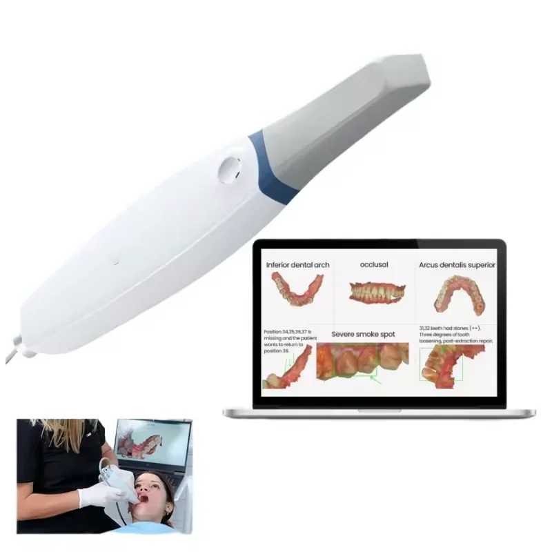 Original V3 PRO  3D Scanner Digital Introral Scanner Wireless for  Orthodontics Restoration Lab Equipment