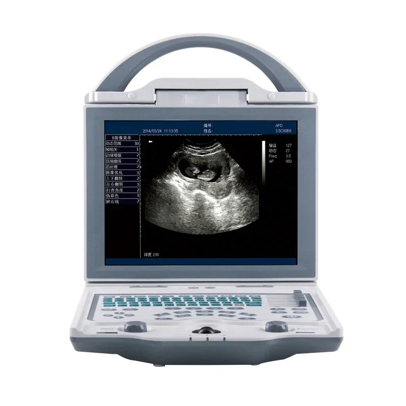 B-Ultrasound Scanner Machine Ultrasound Machine Animal&veterinary Portable Ultrasound Machine