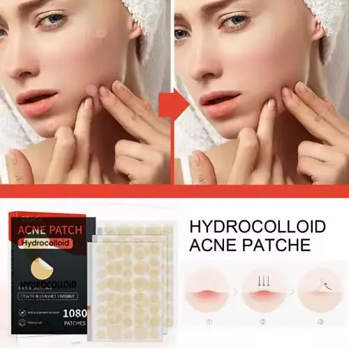 にきびスポット治療,見えないパッチ,にきび治癒のためのハイドロコロイド,720または1080パッチ