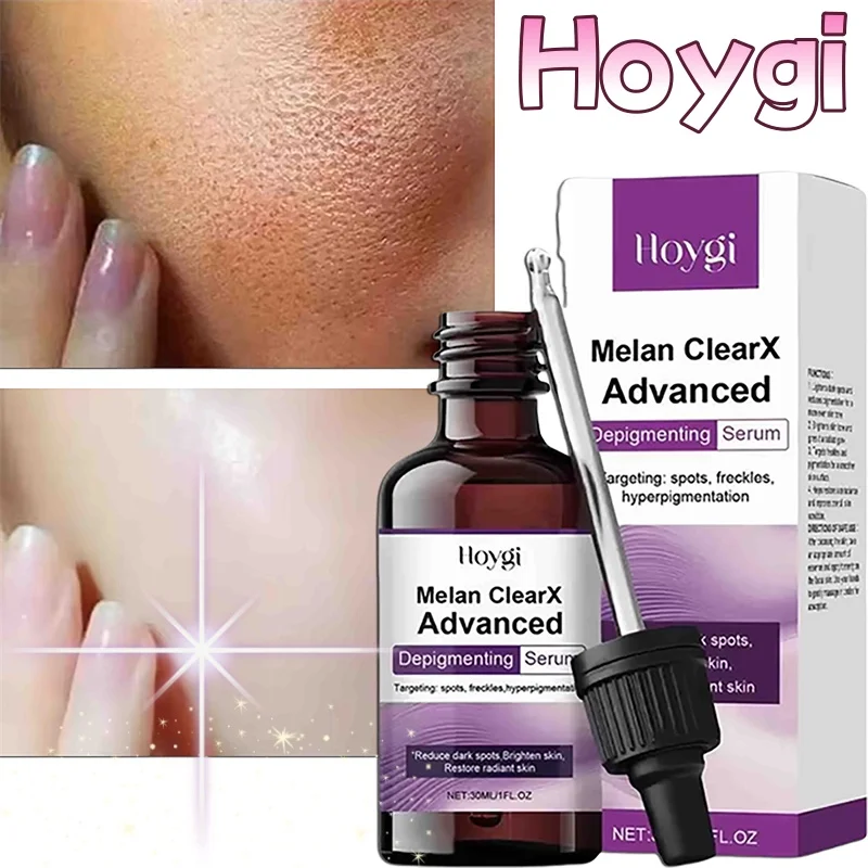 

Niacinamide Serum Dark Spot Correcting Moisturizing Brightening Fade Fine Lines Deep Cleaning Makeup Remover Korean Skin Care