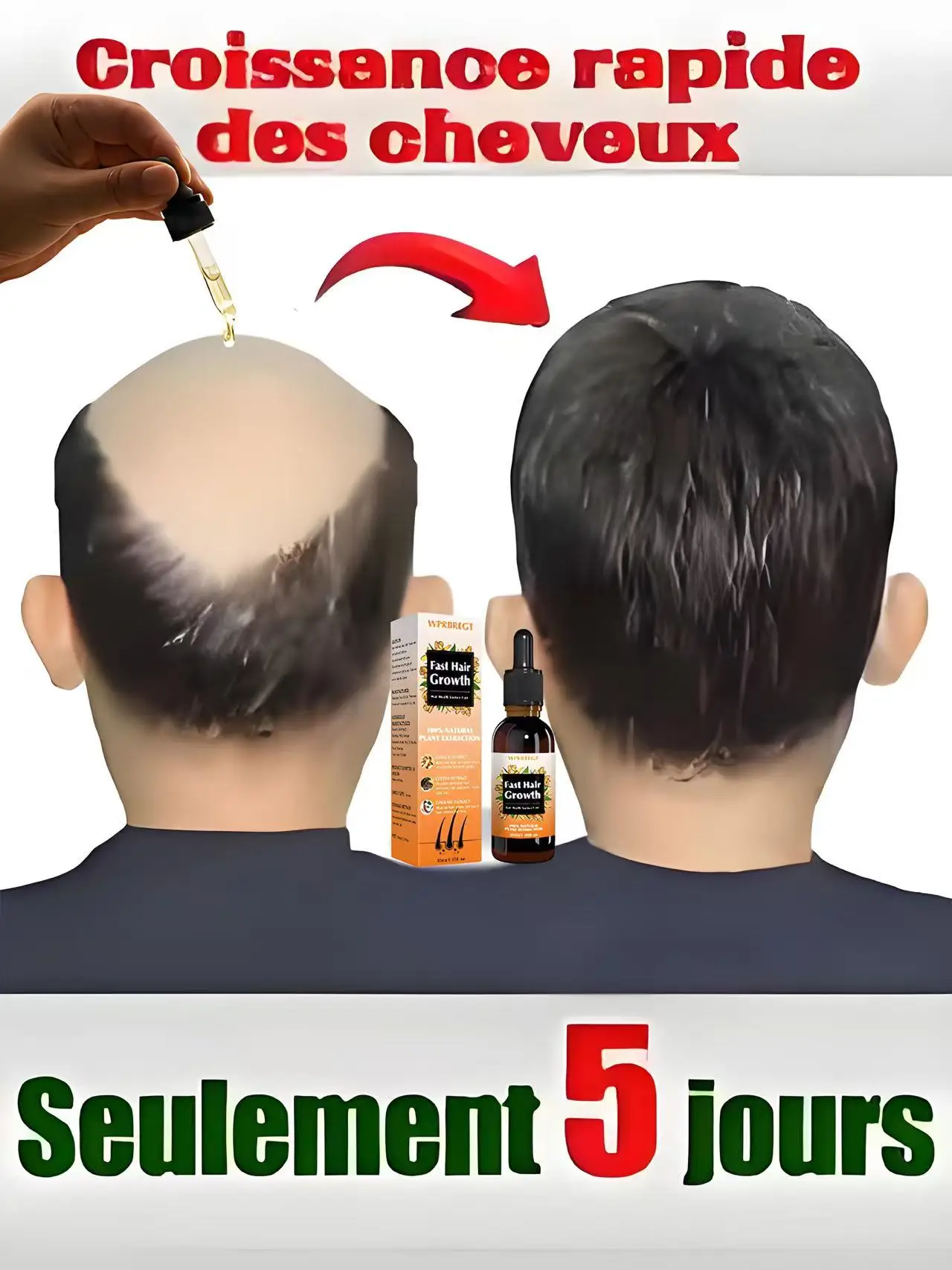 Rᴇᴠɪᴠᴇ Yᴏᴜʀ Tʜɪɴɴɪɴɢ Hᴀɪʀ! Oᴜʀ Hᴀɪʀ Gʀᴏᴡᴛʜ Sᴇʀᴜᴍ Dᴇʟɪᴠᴇʀs Vɪsɪʙʟᴇ Rᴇsᴜʟᴛs Fᴀsᴛ! #1