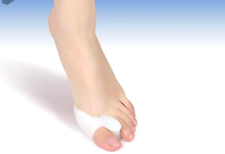 1 paio in bigfoot alluce valgo plantari per alluce valgo toe set di dita dei piedi dell'osso della coscia separatore di dita dei piedi in gel di silice