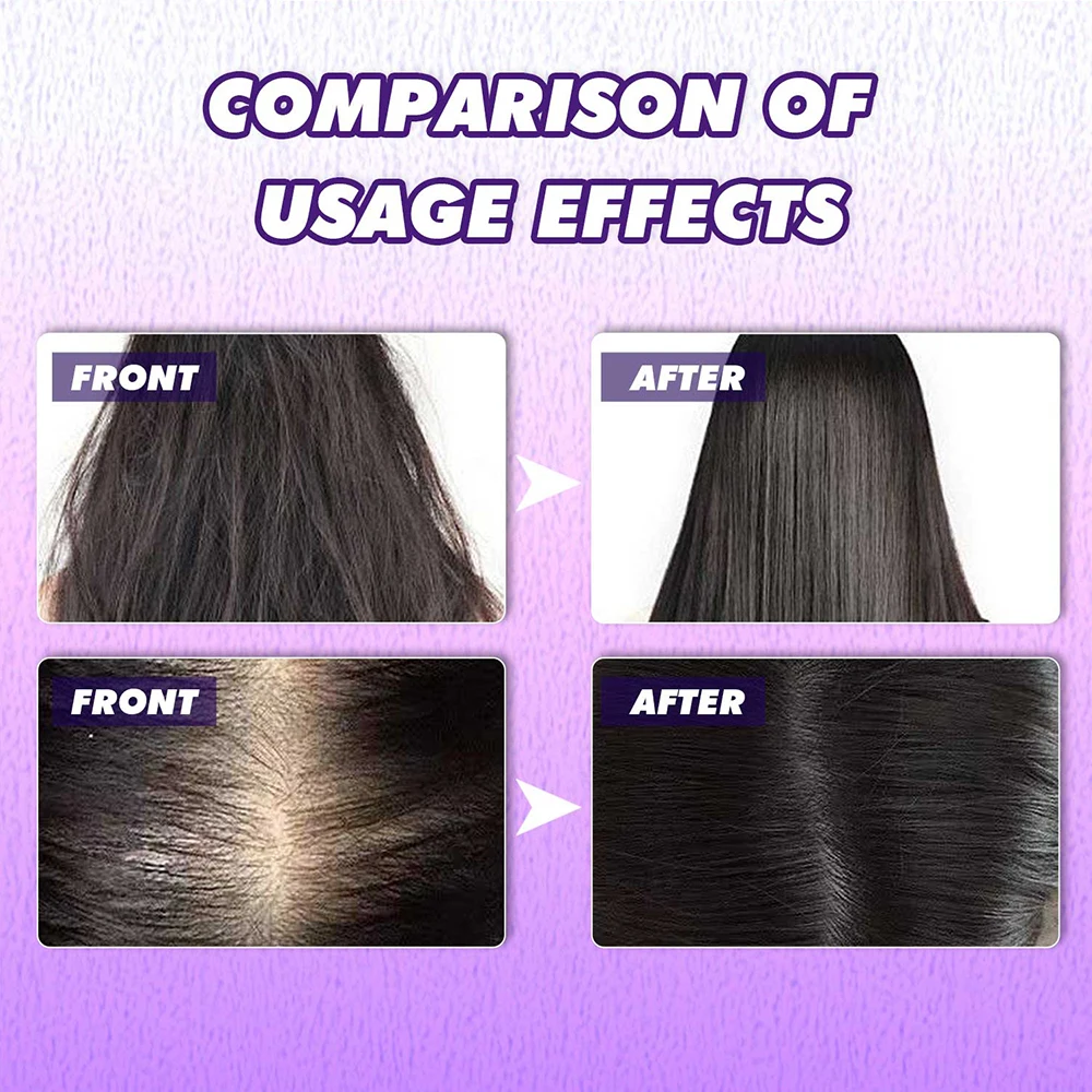 빠른 모발 성장 탈모 방지 오일, 생강 에센셜 하이 헤어 라인 헤드 헤어 세럼, 무모 대머리 증가 에센스 크림, 60ml