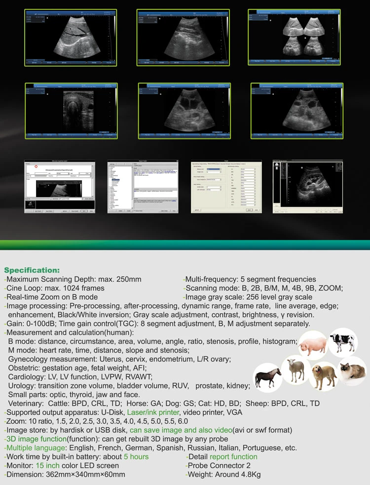 SY-A024 Portable Ultrasound 15 Inch LED Screen Physical Therapy Paper Sonography Machine