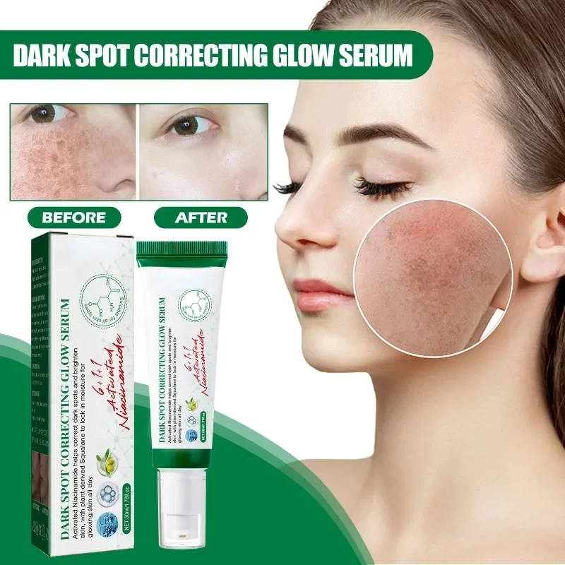 50ml Effective Whitening Freckle Essence Remove Dark Spots Anti Melasma Fade Pigmentation dull repair Brighten facial skin Cream