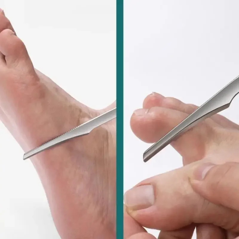 5Pcs Professional Foot Scraper Stainless Steel Foot Care Pedicure Scraper Portable Foot Exfoliating Dead Skin Calluses Tools