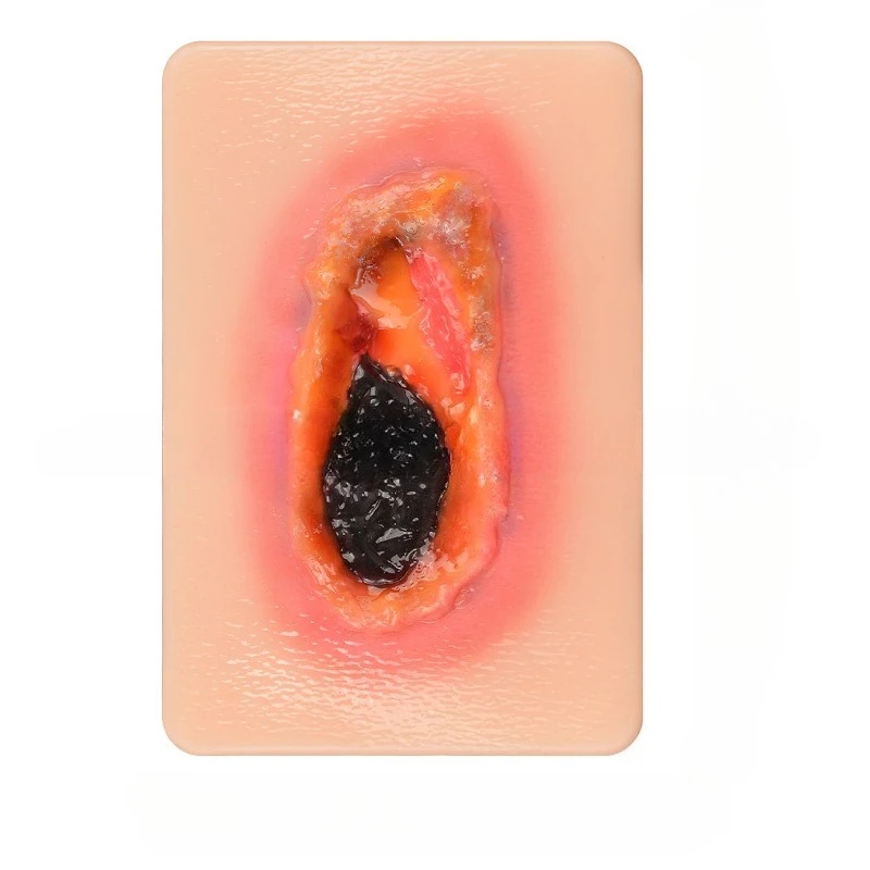 

The best-selling skin trauma models, skin trauma models