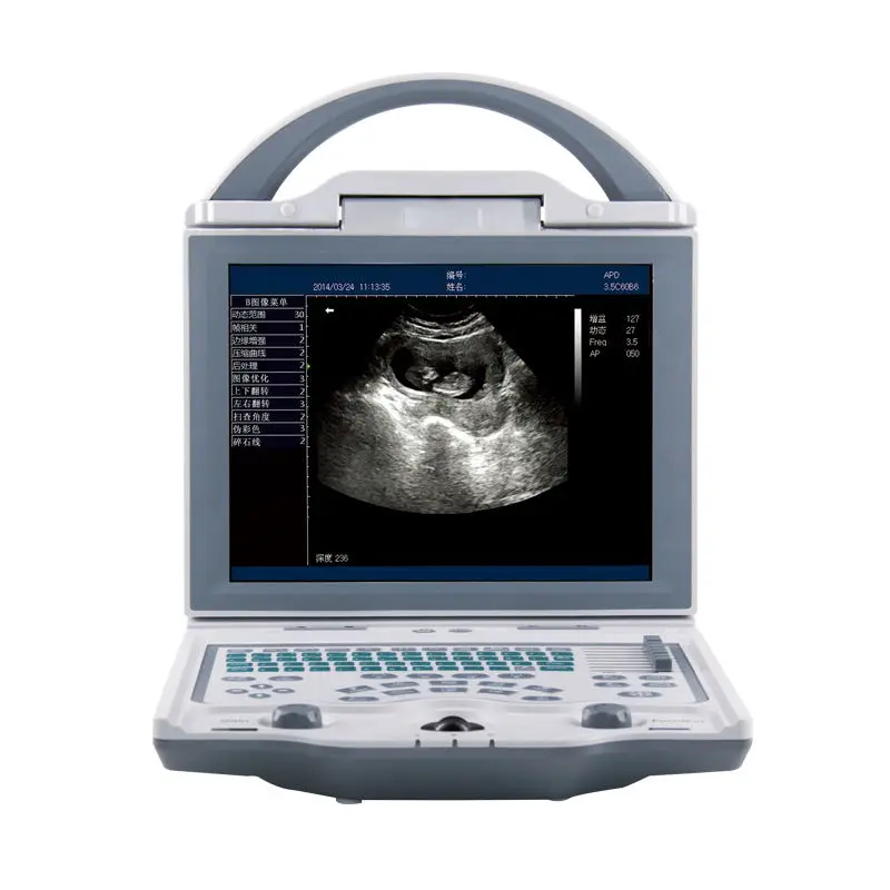 Ultrasound Scanner …