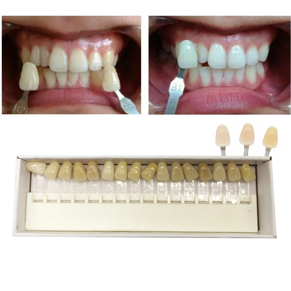 16 Colors Dental Tooth Whitening Shade Guide Denture Porcelain Comparing Model Colorimetric Plate Teeth White Tooth guide A-D