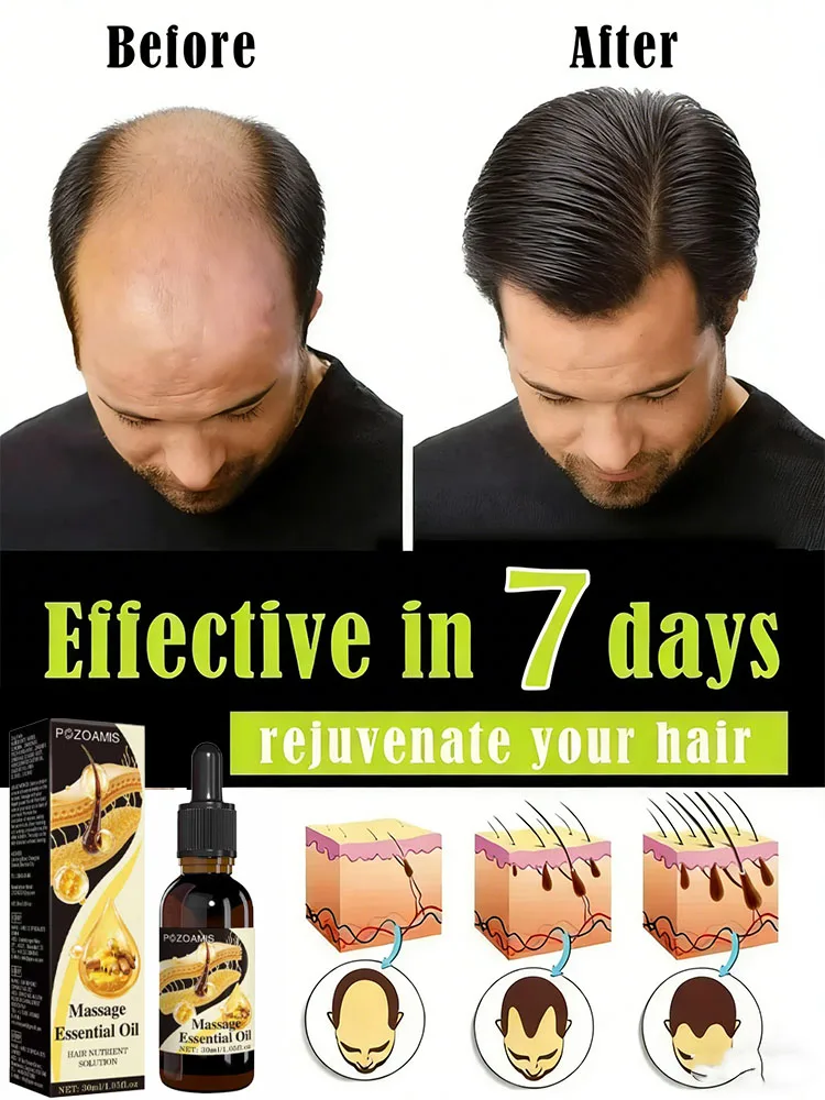 

Питает корни волос, восстанавливает повреждения с корней, делает волосы более густыми.