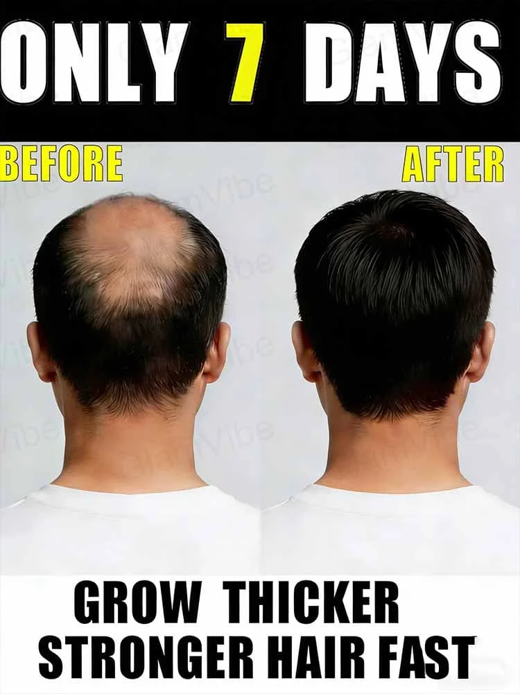 

Боритесь с выпадением волос, восстанавливайте уверенность – применение по мере необходимости.