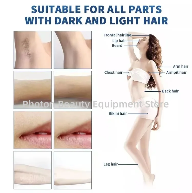 11.11 عرض خاص FAC 4000W 4Wave 808nm سوبرانو ديود جهاز إزالة الشعر بالليزر الكسندريت لإزالة الشعر الدائم 2026