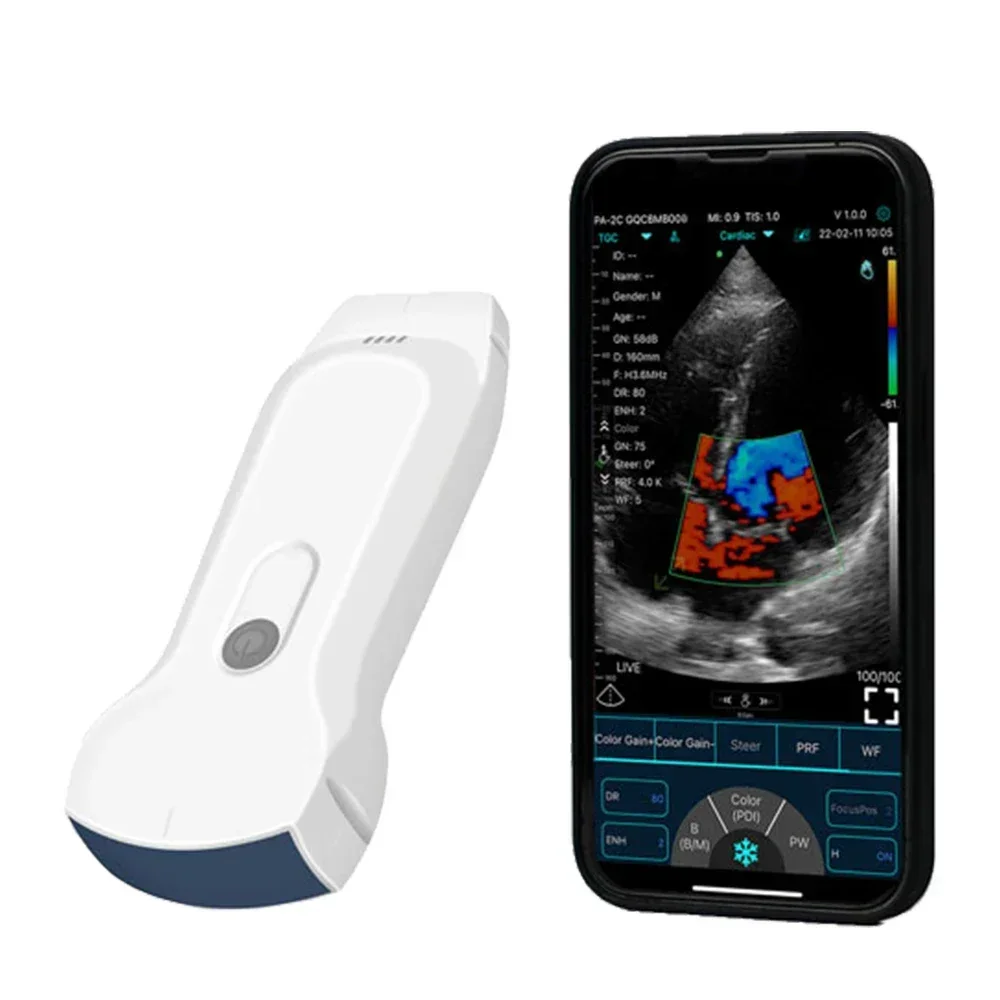 3 in 1 Probe Wireless Ultrasound Scanner Dual Head Convex + Linear + Cardiac Preset C10RL